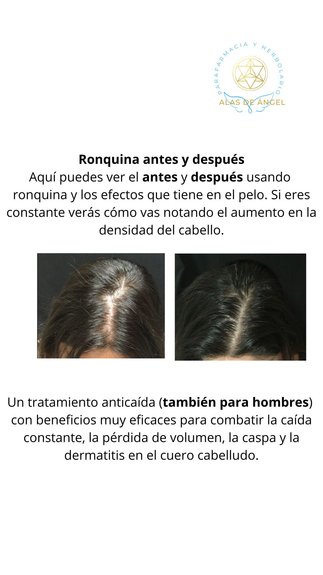 Tónico capilar fortalecedor anti-caída Ron-Quina de Kesmar - Imagen 2